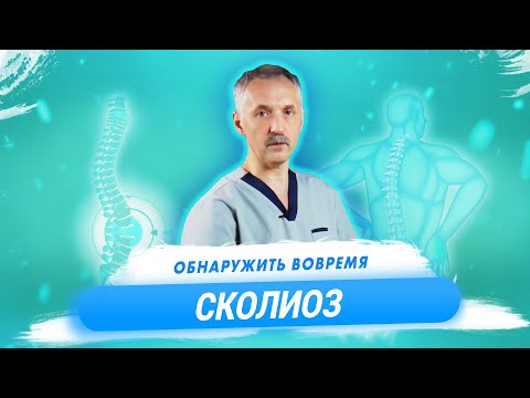 Что такое сколиоз? Симптомы сколиоза на разных стадиях / Доктор Виктор