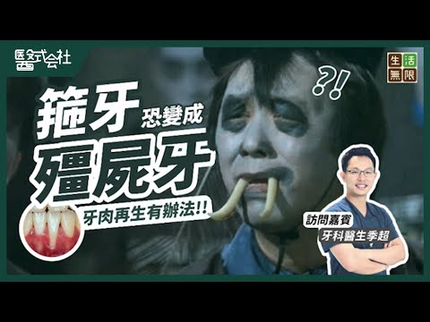 箍牙後竟變喪屍牙！牙肉萎縮可再生｜#醫式会社 (第9集) #生活無限 #補牙 #箍牙 #蛀牙 #牙肉萎縮 #牙周病 #洗牙 #兒童牙科 #治療#殭屍 #podcast