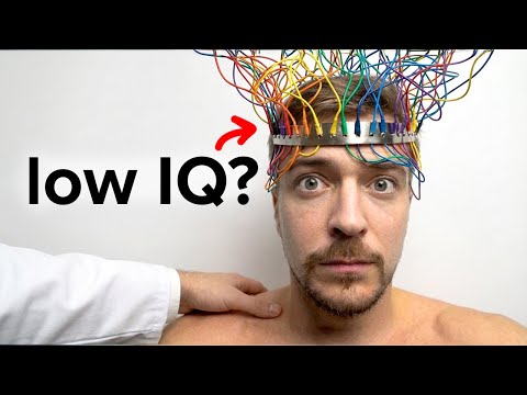 I Gave MrBeast A Brain Scan, Here's What It Said