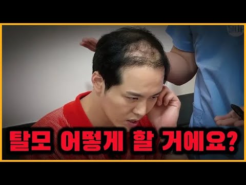 [Hair Transplant] Is hair loss treatment really possible? | Current status of someone with 18 yea...
