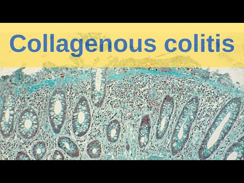 Collagenous Colitis - Pathology mini tutorial