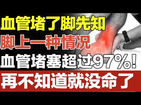 血管堵了脚先知，脚上出现一种情况，说明血管堵塞已经超过97%！再不知道就没命了！#家庭大医生