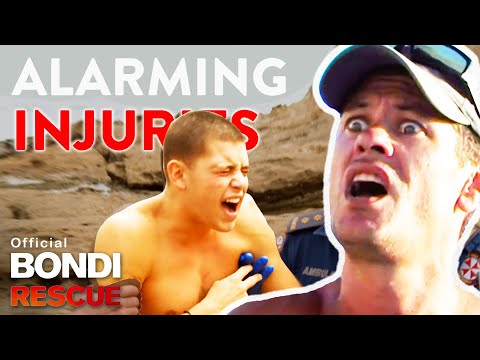 WORST Injuries from Dangerous Rocks