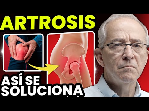 🦴 ARTROSIS Tratamientos Naturales y Consejos para Aliviar el Dolor - Oswaldo Restrepo RSC