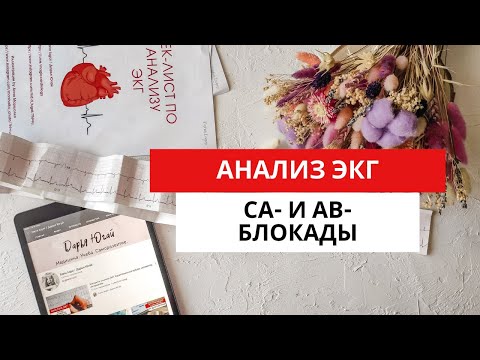 ECG diagnostics of conduction disorders. AV blocks. SA blocks.