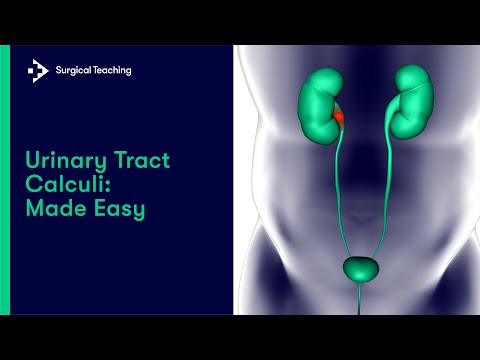 Urinary Tract Stones | All you need to know