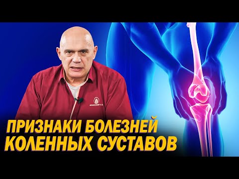 Как лечить боль в коленях при артрите? Причины и первые симптомы артроза коленного сустава