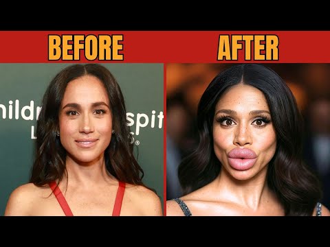 45+ CELEBRITY PLASTIC SURGERY DISASTERS BEFORE AND AFTER
