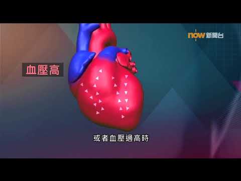 【杏林在線】心臟的終點