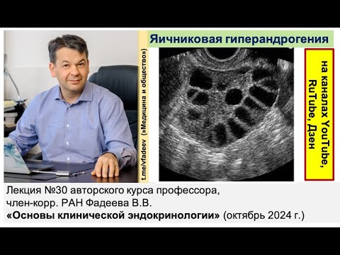 "Яичниковая гиперандрогения"