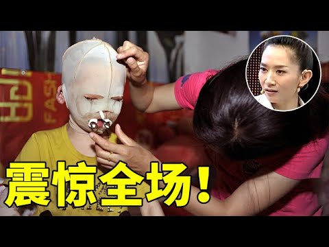 河南女孩一场车祸全身烧伤,带着面具生活,摘下头套全场瞬间沉默了【王芳王为念访谈】