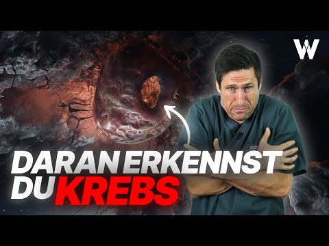 3 Warnzeichen Krebs: Bei diesen Symptomen schnell zum Arzt! Was verbirgt sich hinter B-Symptomatik?