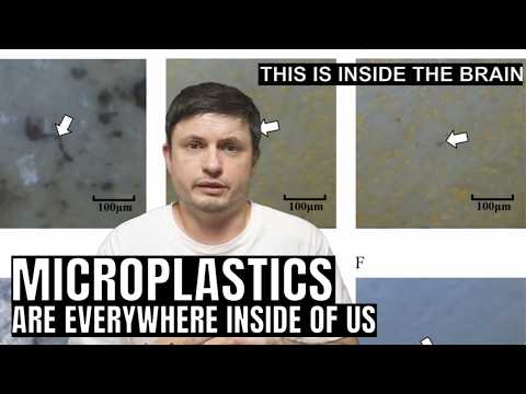 Alarming Effects From Microplastics on Human Health (Several Major Studies)