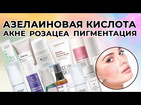 АЗЕЛАИНОВАЯ КИСЛОТА. НЕ ЗНАКОМЫ? / АКНЕ, РОЗАЦЕА, ПИГМЕНТАЦИЯ