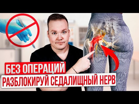 Защемило СЕДАЛИЩНЫЙ нерв. Делай СРОЧНО эти упражнения ДОМА. Боль уйдет за 5 минут