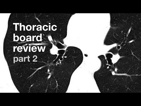 Board Review | Thoracic Radiology | Part 2