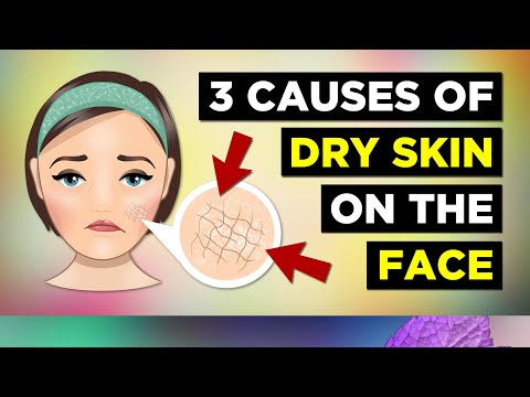 3 Causes Of Dry Skin On The Face (Dry Skin Remedies)