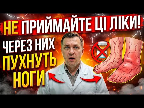 ‼️ПЕНСІОНЕРИ УВАГА! Ці 9 ліків викликають НАБРЯКИ НІГ! Перевірте себе!