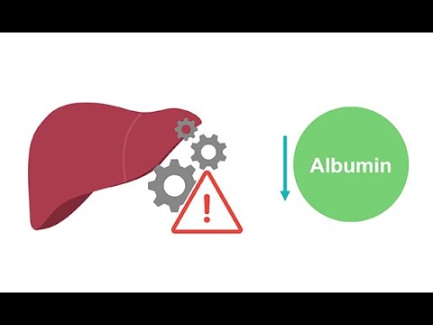 Getting to know albumin physiology