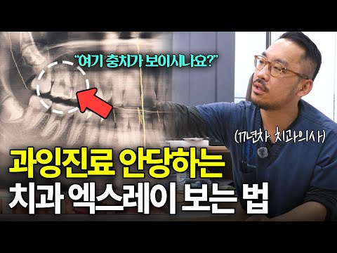알아야 안당합니다 l 치과의사처럼 엑스레이 보는 법