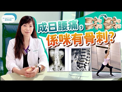 骨刺引起腰痛? 了解什麼是骨刺? 如果有骨刺係咪一定要做手術? 骨刺有多可怕, 怎樣強化腰部減少骨刺生長-脊醫王鳳恩
