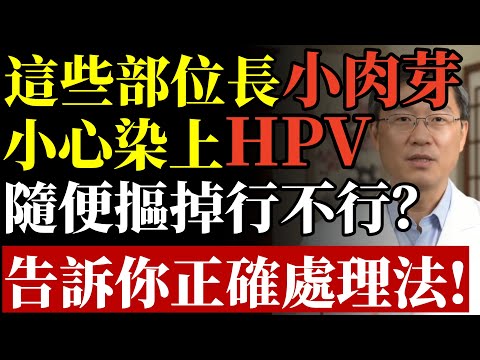 這些部位長小肉芽？小心染上HPV！隨便摳掉行不行？告訴你正確處理法！#HPV #菜花 #尖銳濕疣 #皮膚健康 #癌症預防 #傳染病 #免疫力 #家庭衛生 #疫苗 #健康知識