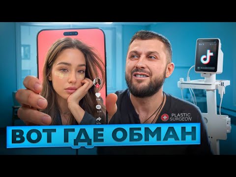 БЛЕФАРОПЛАСТИКА. Мифы в которые Верят : Осложнения, Отёки, Советы хирурга