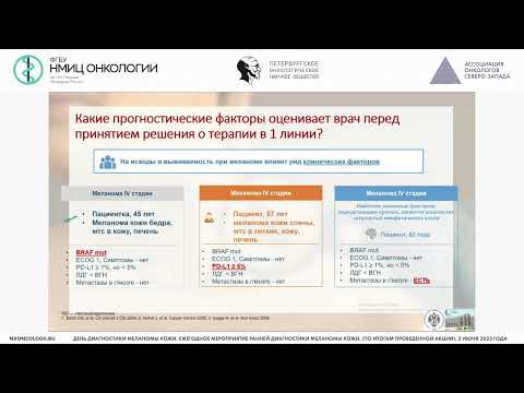 Лекарственная терапия при меланоме кожи