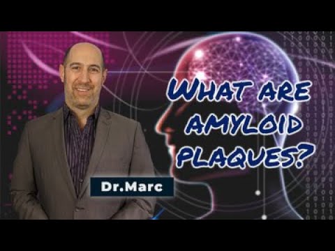 What are Amyloid Plaques? | Dr. Marc