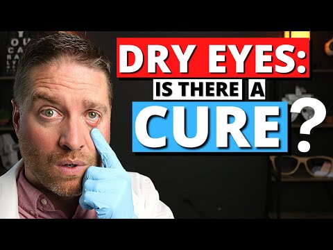 DRY EYES: Is There A Cure? - Dry Eye Syndrome Explained