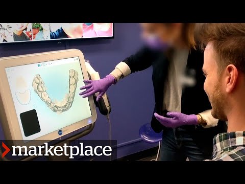 Testing SmileDirectClub: Hidden camera investigation (Marketplace)