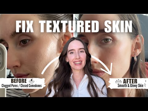 How to get rid of CLOGGED PORES | Bye closed comedones - routine & products