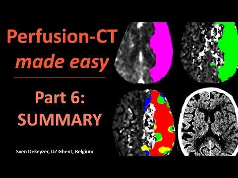 Perfusion CT made easy - part 6 - Summary