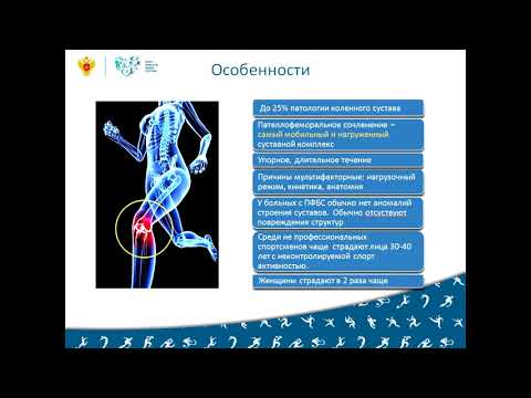 Пателлофеморальный болевой синдром