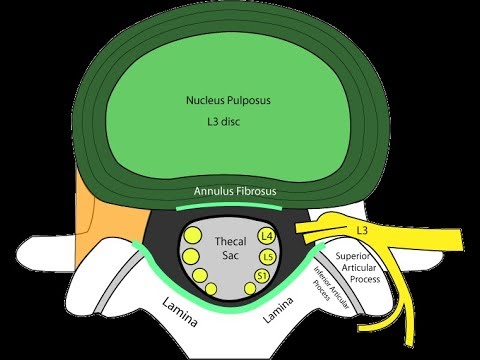 How to Read Your MRI with Onis 2.5 – part I (Advanced Lumbar Spine)