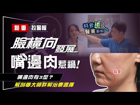 嘴邊肉下垂的速度竟這麼快？ 專家示警：嘴邊肉每年下垂____mm 美女醫師聽完傻眼了 科普醫美新知 312-20230411