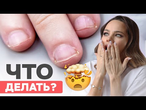 Nail tech's worst nightmare | How to extend bitten nails
