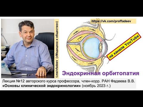 Эндокринная орбитопатия