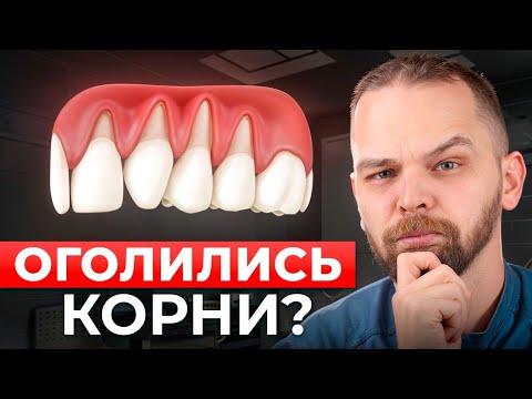 Опустилась десна? Вот что нужно сделать