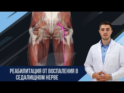 Как убрать воспаление седалищного нерва