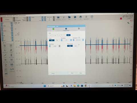 Using the Picoscope  and Serial Decoding to Analyze CAN Bus Data