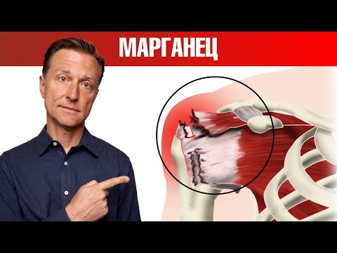Повреждение ротаторной манжеты плеча💪Восстановление сухожилия
