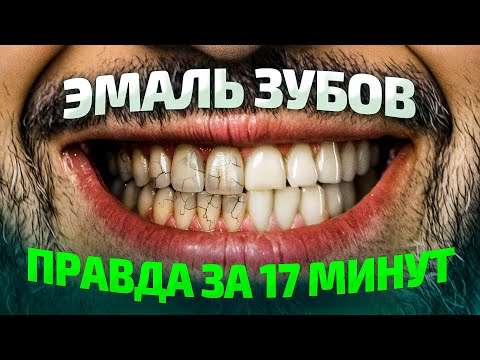 Все про ЭМАЛЬ ЗУБОВ за 17 минут. Можно ли восстановить эмаль зубов?