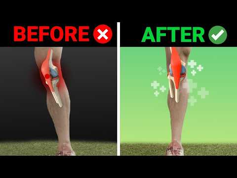 How To Un-Fu*k Your Knee - Fix Patellafemoral Pain, Inner/Outer Knee Pain, & More