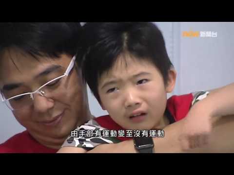 【杏林在線】雷特氏症