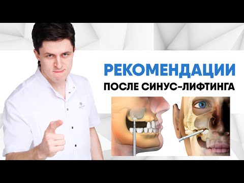 Рекомендации после операции синус-лифтинг (Sinus-lift) [ открытый и закрытый синус-лифтинг ].
