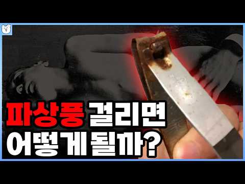 파상풍이 이렇게 무서운 병이라고?