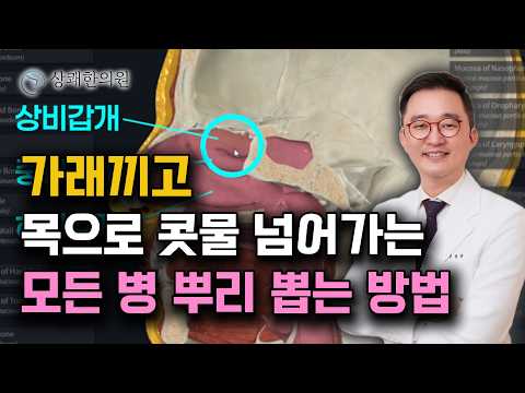 목 뒤로 끝없이 넘어가는 가래 콧물 완전히 말려버리는 방법 ㅣ이비인후과 의사도 안 가르쳐주는 비강과 후강에 숨겨진 해부학적 비밀