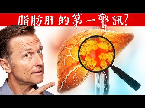 有脂肪肝的第一警訊?修復脂肪肝,自然療法,柏格醫生 Dr Berg