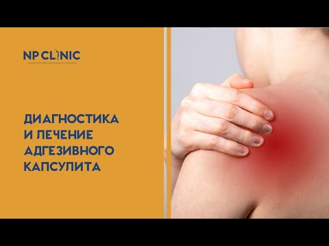 Диагностика и лечение адгезивного капсулита